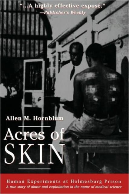 Acres of Skin : Human Experiments at Holmesburg Prison, Paperback / softback Book