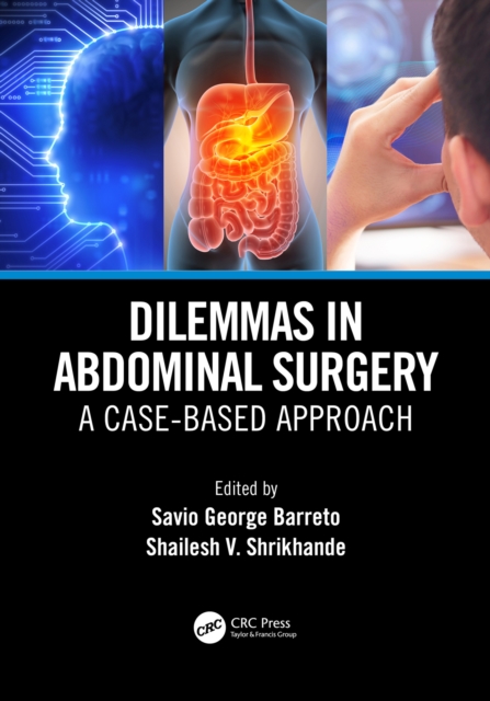 Dilemmas in Abdominal Surgery : A Case-Based Approach, EPUB eBook