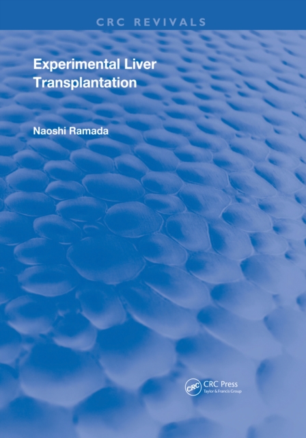 Experimental Liver Transplantation, PDF eBook