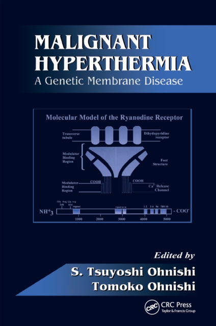 Malignant Hyperthermia : A Genetic Membrane Disease, EPUB eBook