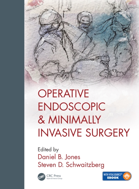 Operative Endoscopic and Minimally Invasive Surgery, EPUB eBook