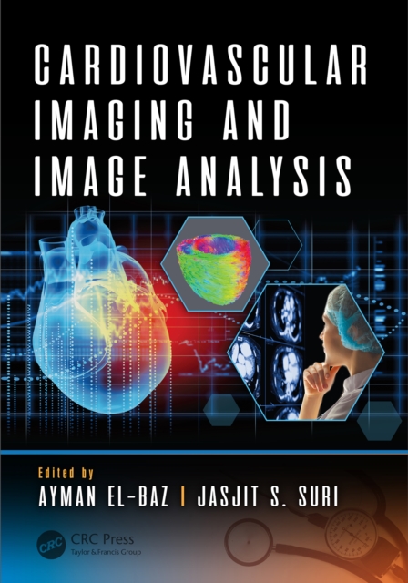 Cardiovascular Imaging and Image Analysis, EPUB eBook