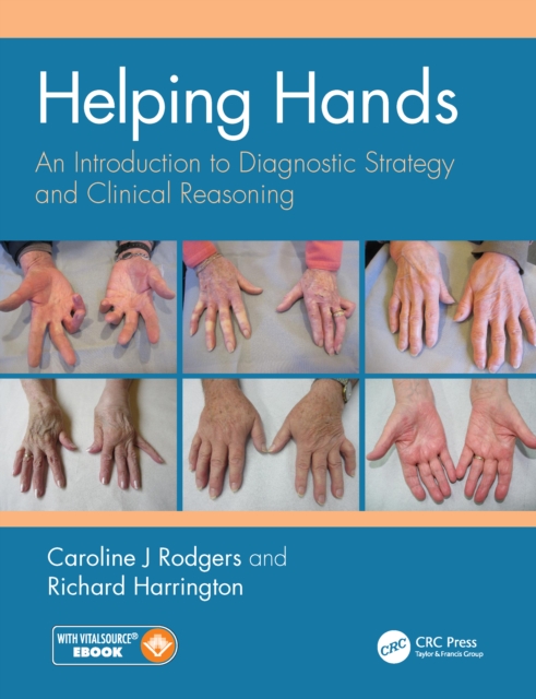 Helping Hands : An Introduction to Diagnostic Strategy and Clinical Reasoning, EPUB eBook