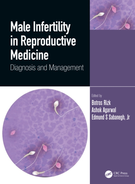 Male Infertility in Reproductive Medicine : Diagnosis and Management, PDF eBook