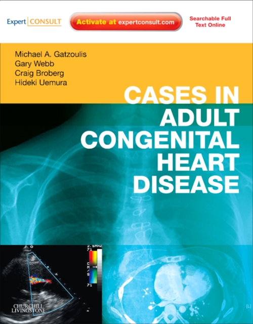 Cases in Adult Congenital Heart Disease - Expert Consult: Online and Print : Atlas, Hardback Book