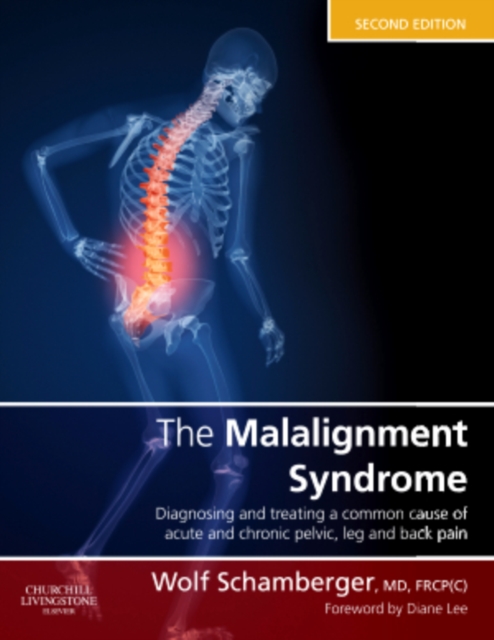 The Malalignment Syndrome : diagnosis and treatment of common pelvic and back pain, Hardback Book
