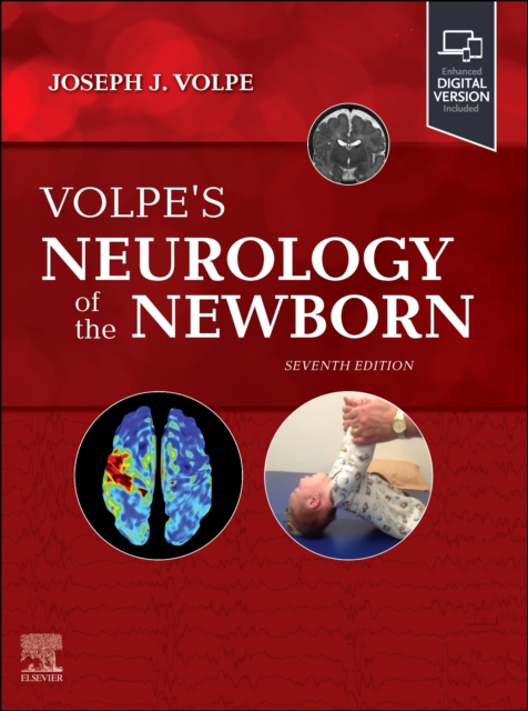 Volpe's Neurology of the Newborn, Hardback Book
