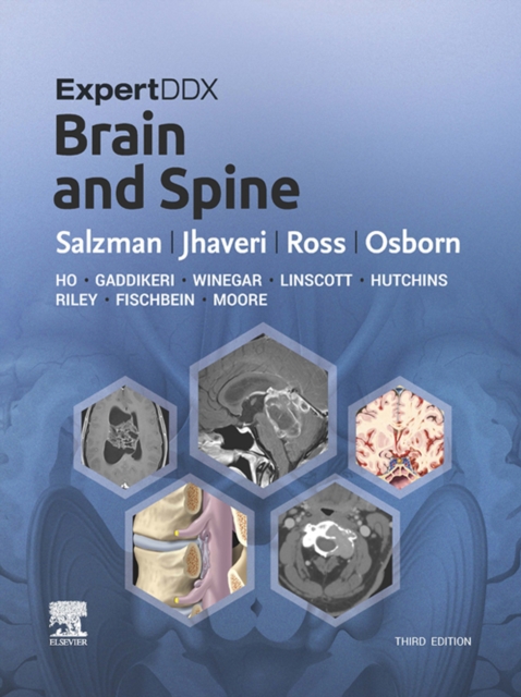 ExpertDDx: Brain and Spine E-Book : ExpertDDx: Brain and Spine E-Book, EPUB eBook