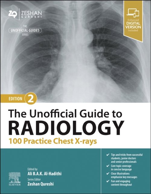 The Unofficial Guide to Radiology: 100 Practice Chest X-rays, Paperback / softback Book