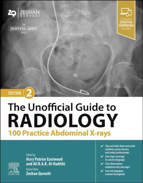 The Unofficial Guide to Radiology: 100 Practice Abdominal X-rays, Paperback / softback Book