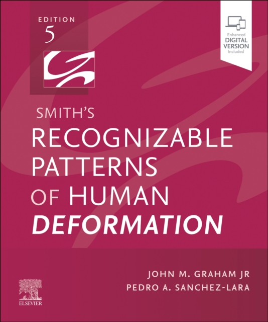 Smith's Recognizable Patterns of Human Deformation, Paperback / softback Book
