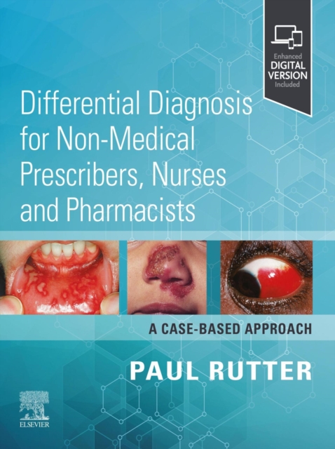 Differential Diagnosis for Non-medical Prescribers, Nurses and Pharmacists: A Case-Based Approach : Differential Diagnosis for Non-medical Prescribers, Nurses and Pharmacists: A Case-Based Approach -, EPUB eBook