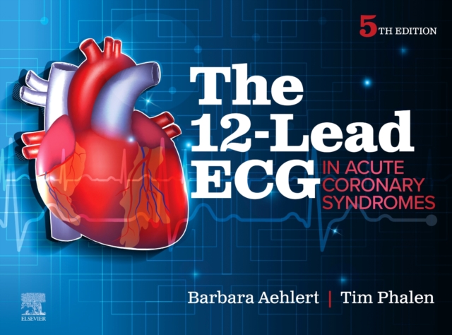 The 12-Lead ECG in Acute Coronary Syndromes, Paperback / softback Book
