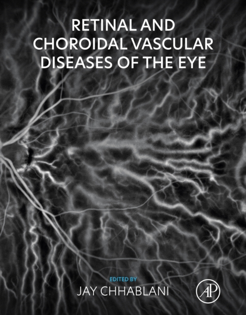Retinal and Choroidal Vascular Diseases of the Eye, EPUB eBook