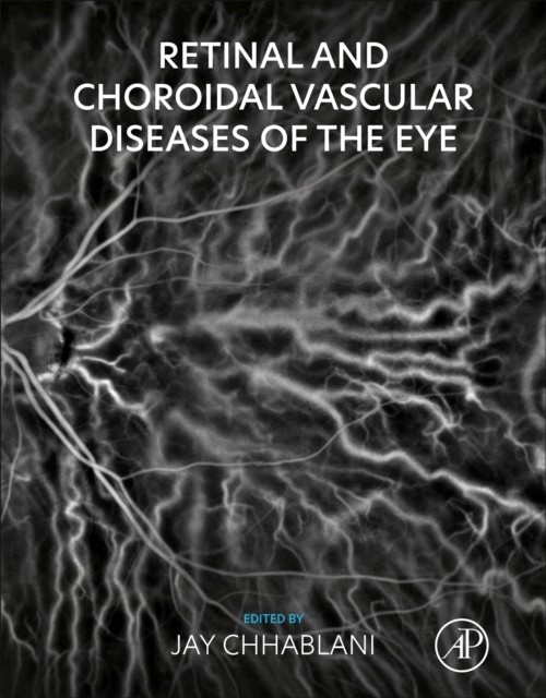 Retinal and Choroidal Vascular Diseases of the Eye, Paperback / softback Book