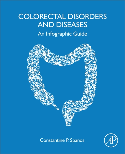 Colorectal Disorders and Diseases : An Infographic Guide, Paperback / softback Book