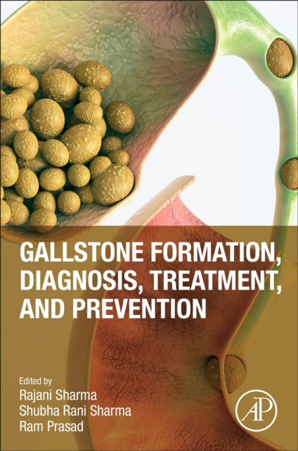 Gallstone Formation, Diagnosis, Treatment and Prevention, Paperback / softback Book