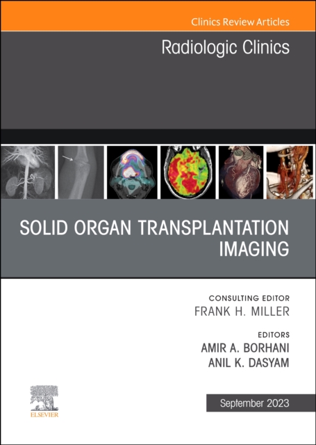 Solid organ transplantation imaging, An Issue of Radiologic Clinics of North America : Volume 61-5, Hardback Book
