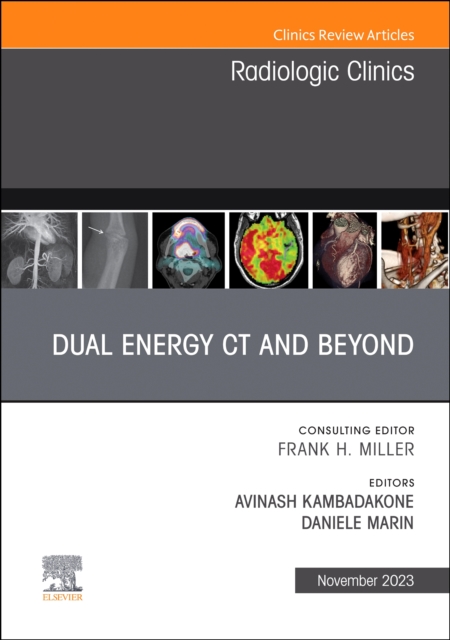 Dual Energy CT and Beyond, An Issue of Radiologic Clinics of North America : Volume 61-6, Hardback Book