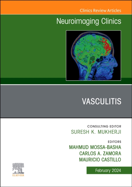 Vasculitis, An Issue of Neuroimaging Clinics of North America : Volume 34-1, Hardback Book
