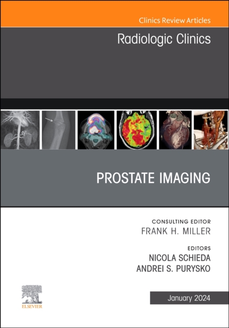 Prostate Imaging, An Issue of Radiologic Clinics of North America : Volume 62-1, Hardback Book
