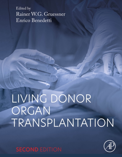 Living Donor Organ Transplantation, EPUB eBook