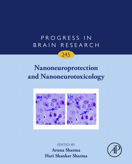 Nanoneuroprotection and Nanoneurotoxicology, EPUB eBook