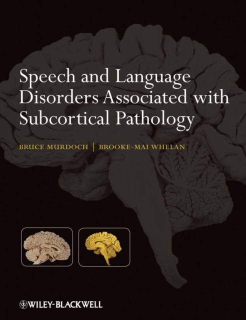 Speech and Language Disorders Associated with Subcortical Pathology, Paperback / softback Book