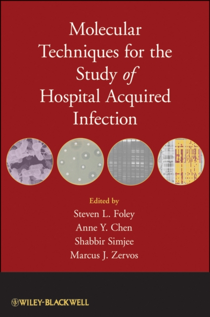 Molecular Techniques for the Study of Hospital Acquired Infection, Hardback Book