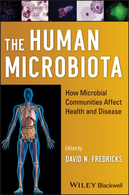 The Human Microbiota : How Microbial Communities Affect Health and Disease, Hardback Book