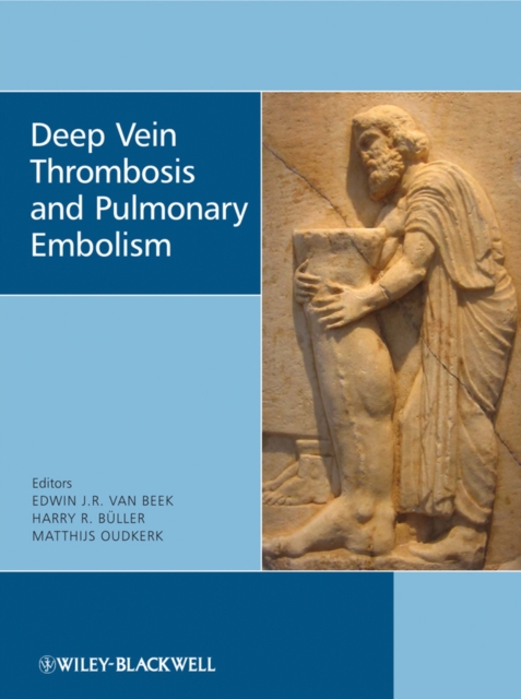 Deep Vein Thrombosis and Pulmonary Embolism, Hardback Book