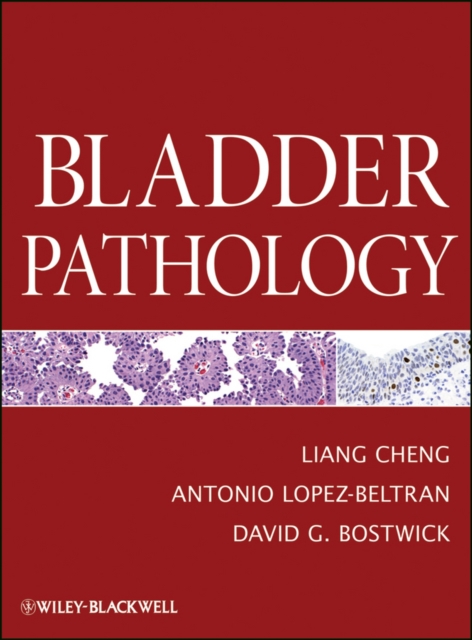 Bladder Pathology, Hardback Book