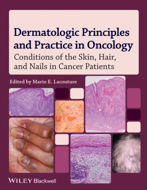 Dermatologic Principles and Practice in Oncology : Conditions of the Skin, Hair, and Nails in Cancer Patients, Hardback Book