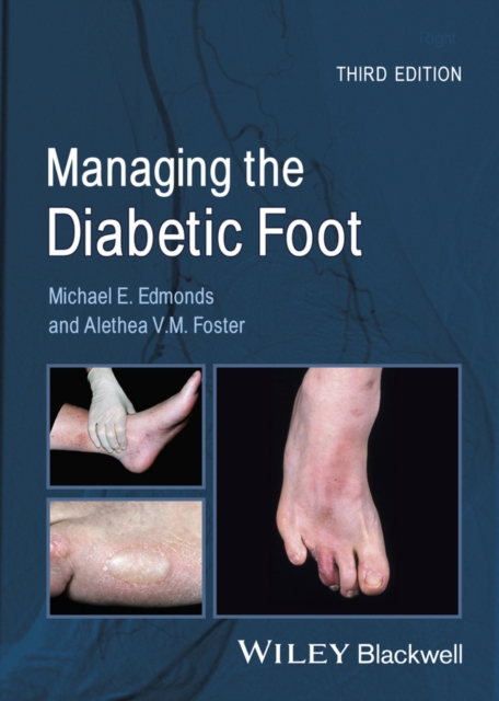 Managing the Diabetic Foot, Paperback / softback Book