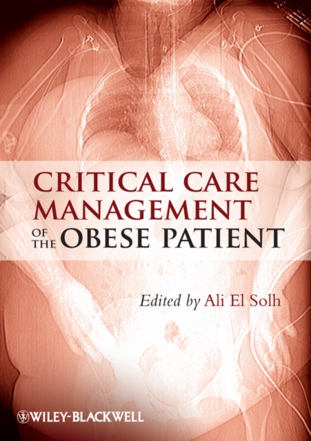Critical Care Management of the Obese Patient, Hardback Book