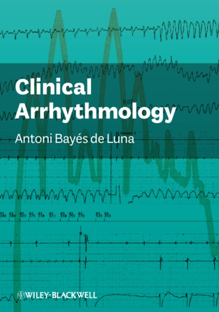 Clinical Arrhythmology, Hardback Book