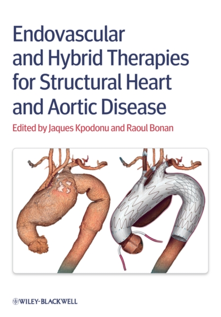 Endovascular and Hybrid Therapies for Structural Heart and Aortic Disease, Hardback Book
