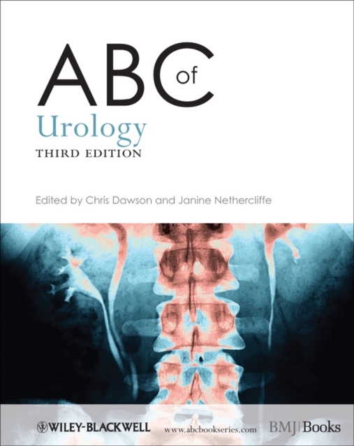 ABC of Urology, Paperback / softback Book