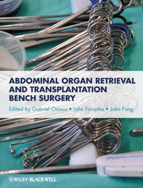 Abdominal Organ Retrieval and Transplantation Bench Surgery, Hardback Book