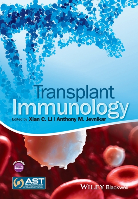 Transplant Immunology, Paperback / softback Book