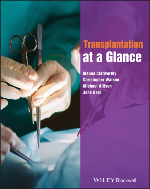 Transplantation at a Glance, Paperback / softback Book