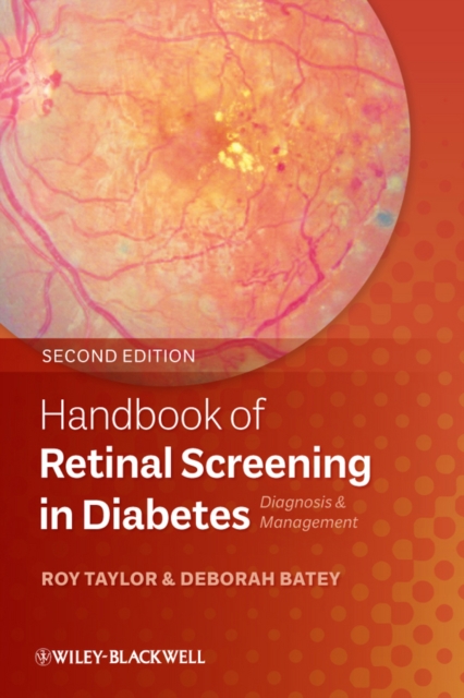 Handbook of Retinal Screening in Diabetes - Diagnosis and Management 2e, Paperback / softback Book