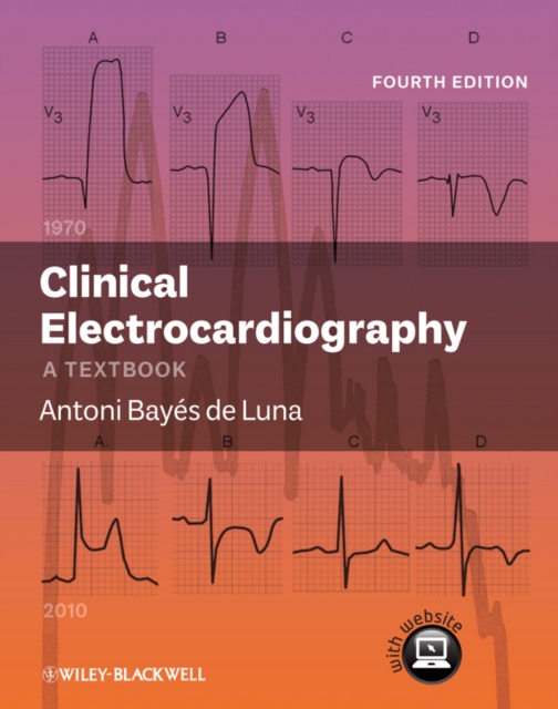 Clinical Electrocardiography : A Textbook, Hardback Book
