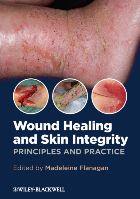 Wound Healing and Skin Integrity : Principles and Practice, Paperback / softback Book