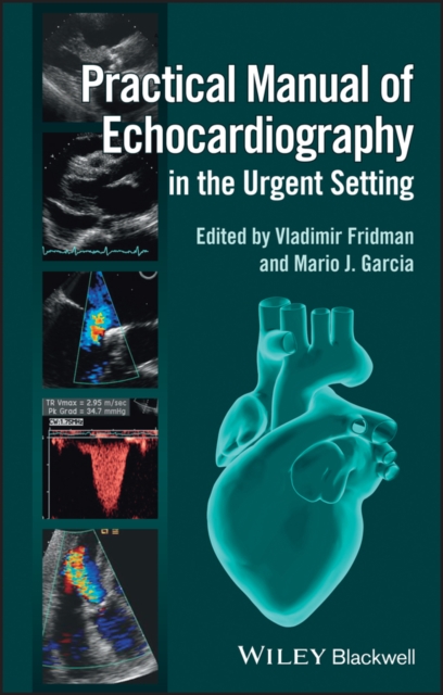 Practical Manual of Echocardiography in the Urgent Setting, Paperback / softback Book