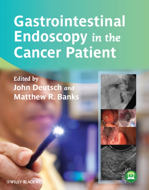 Gastrointestinal Endoscopy in the Cancer Patient, Hardback Book