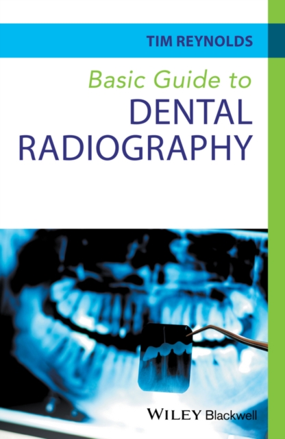 Basic Guide to Dental Radiography, Paperback / softback Book
