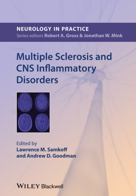 Multiple Sclerosis and CNS Inflammatory Disorders, Paperback / softback Book