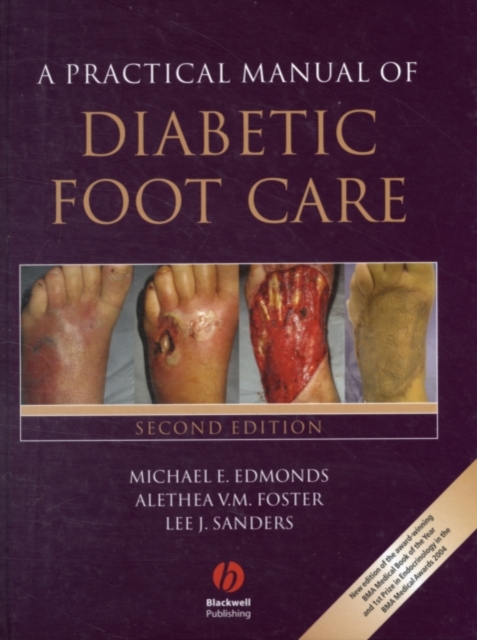 A Practical Manual of Diabetic Foot Care, PDF eBook