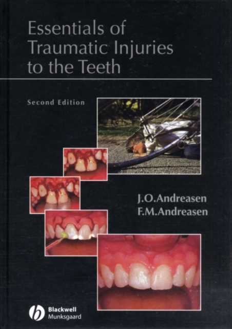 Essentials of Traumatic Injuries to the Teeth : A Step-by-Step Treatment Guide, PDF eBook